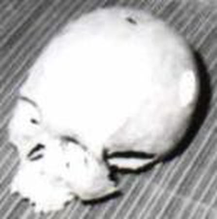 The mystery of the pierced skull of Rennes-le-Château
