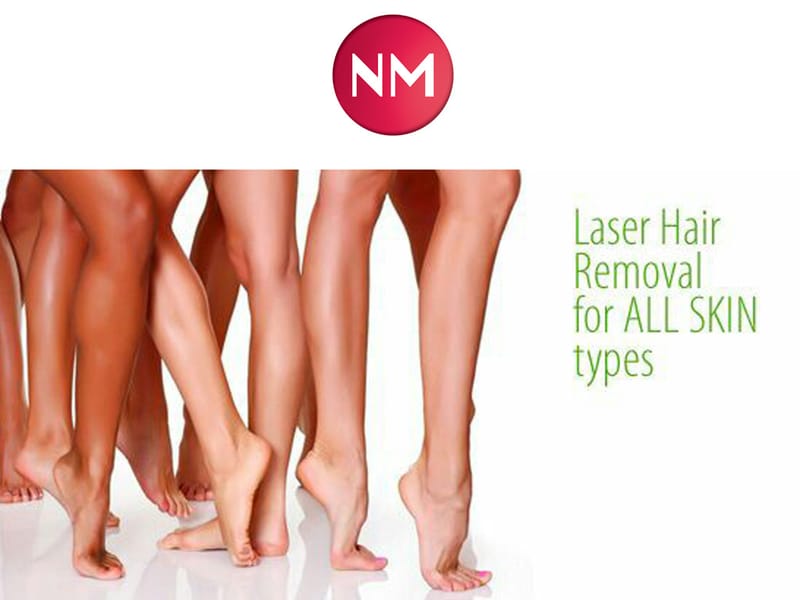 טיפולי הסרת שיער בשיטות מתקדמות