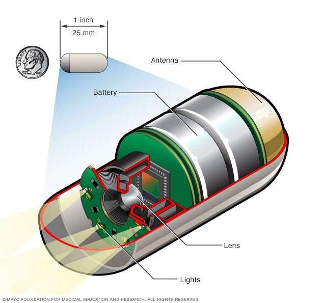 Capsule Endoscopy