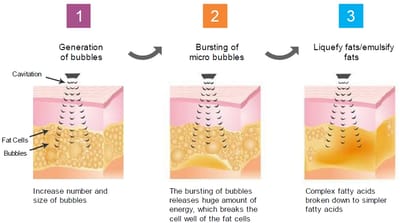 The Importance of Aftercare image