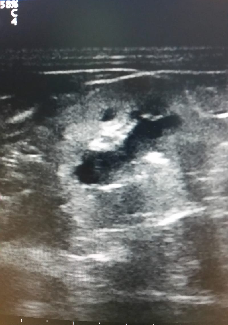 ECOGRAFIA ADDOMINALE