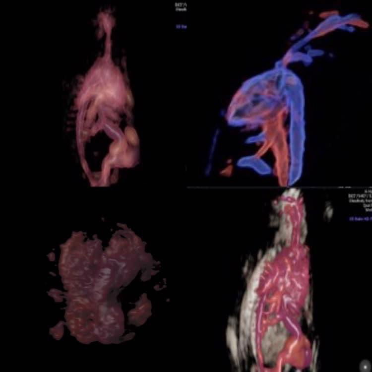 Ecocardiografia Fetal