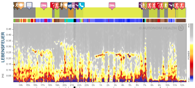 Herzratenvariabilität HRV image