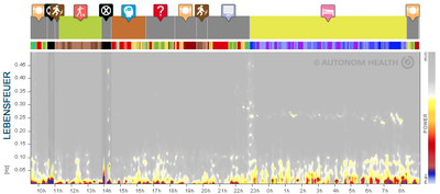 Herzratenvariabilität HRV image