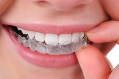 Braces &amp; Dentures image