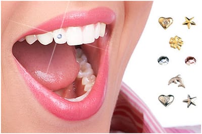 Dental Jewellery image