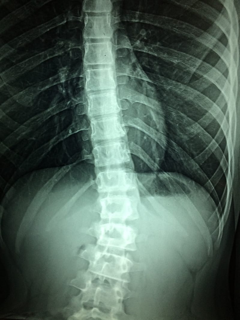 The Spinal Cord