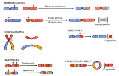 Malformaciones cromosómicas