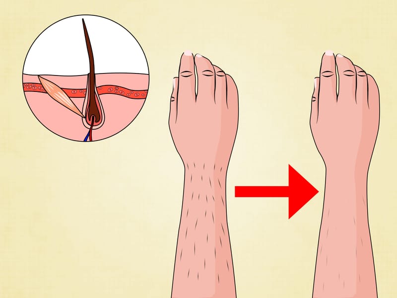 ZEL'S LASER TREATMENT & OTHER SERVICES