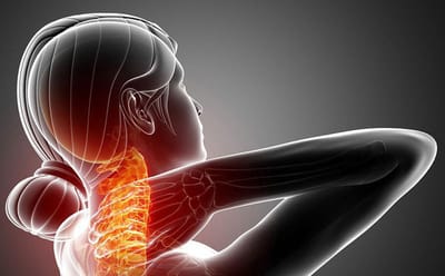 4 thuốc giảm đau vai gáy hiệu quả hiện nay