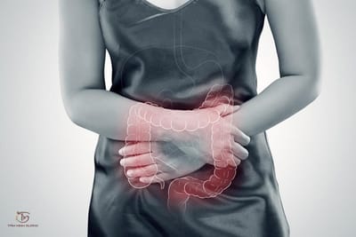 Viêm đại tràng sigma là gì? Nguyên nhân, triệu chứng và cách điều trị