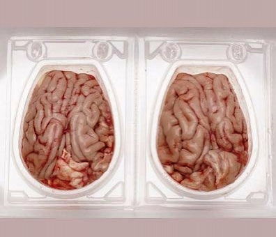 Cerebro de cerdo