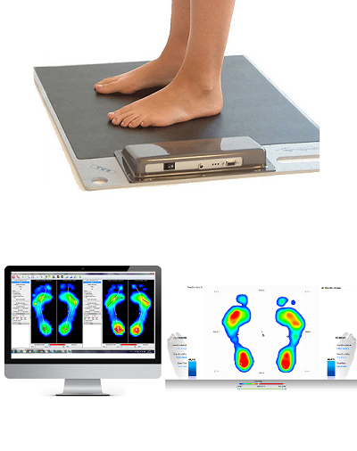 Baropodometria Computadorizada (teste da pisada)
