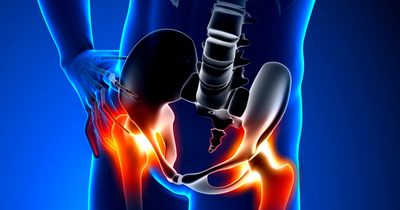 Precautions You Have To Take After The Hip Replacement Surgery