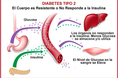 Como Prevenir Las Diabetes Tipo 2 image