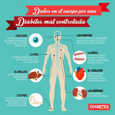 Organos Afectados Por La Enfermedad image
