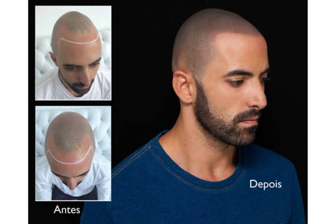 EM BREVE!