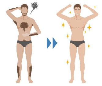 DEPILAÇÃO MASCULINA