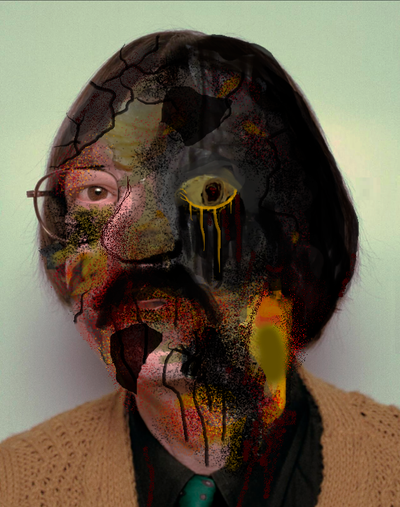 Infectologia: Sarcoma de Edgar Soliz y apuntes de un extraño