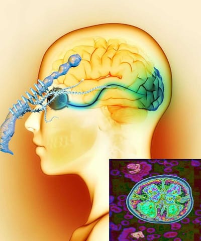 ACTIVIDAD PARASITARIA por José Rengifo Delgado (segunda parte)
