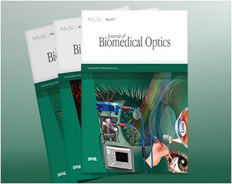 Optical coherence tomography image denoising using Gaussianization transform