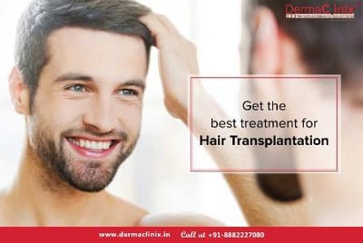 Is Hair transplant a Safe Option?