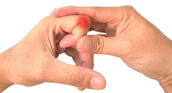 Por qué suenan los nudillos al tronarlos.