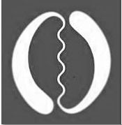 מהי קרמינולוגיה קלינית image