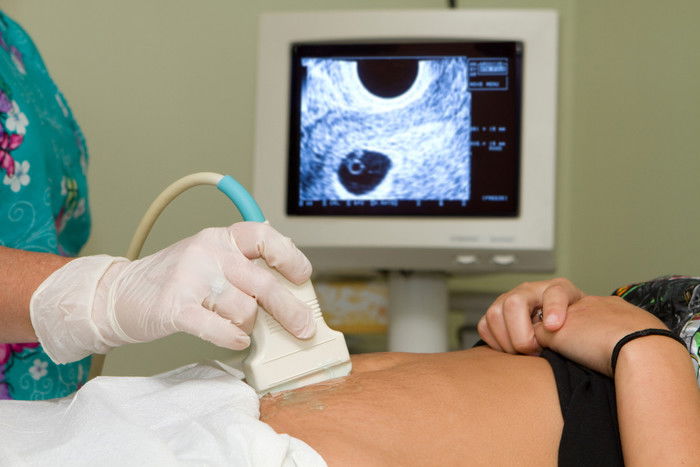 WE OFFER FREE SCANS WITHIN 20 MINUTES TO HELP US TO KNOW THE STAGE OF PREGNANCY CALL 0742269651 Book 0782001462