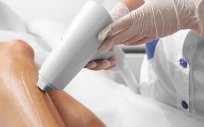 آیا می توان بعد از رفع موهای زائد بوسیله لیزر، پوست خود را برنزه کرد؟