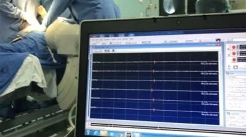 MONITOREO INTRAOPERATORIO
