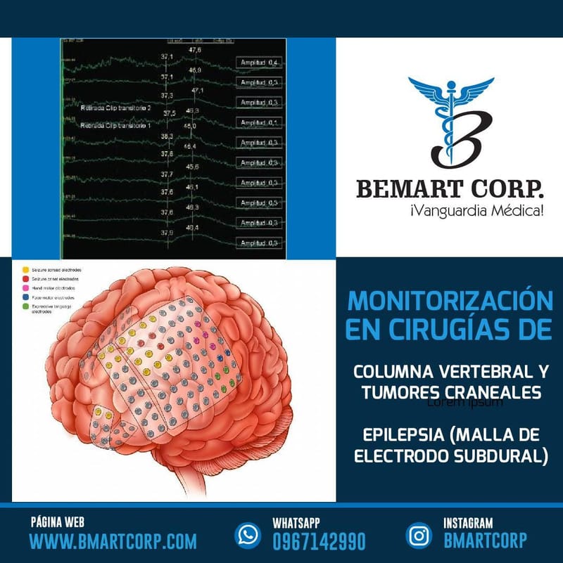 Profesional Especialista En ¨Neurofisología Clínica" Con Aval De Senescyt