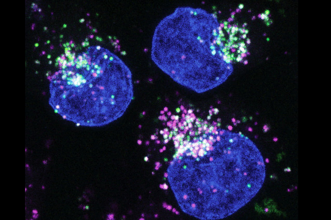 Cancer Metabolic Therapy - Thomas Seyfried