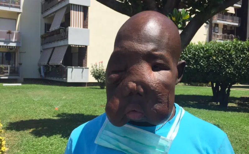 La storia di Prosper “L’uomo Elefante” alla Casa d’Italia