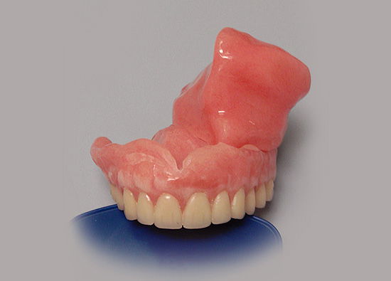 Obturator for palatal resection – A case sequel