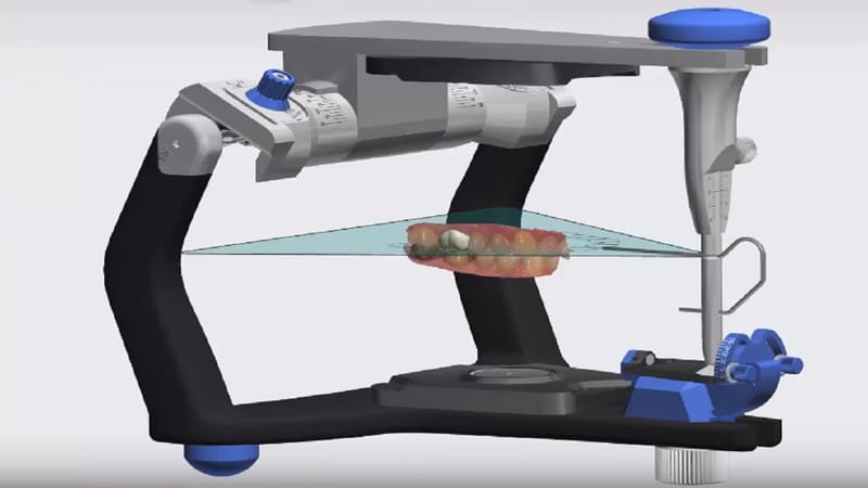 Virtual Articulators: A promising technology of the future