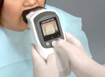 Shade selection: Spectrophotometer vs Digital camera – a comparative in-vitro study