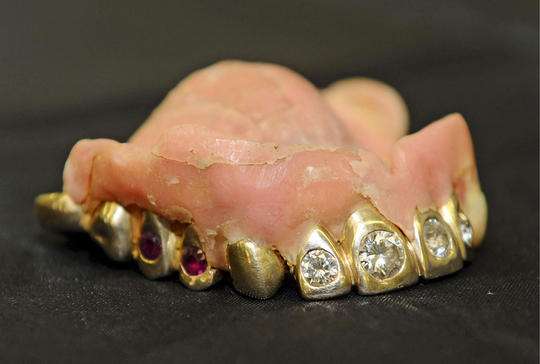 Role of prosthodontist in forensic science - A review article