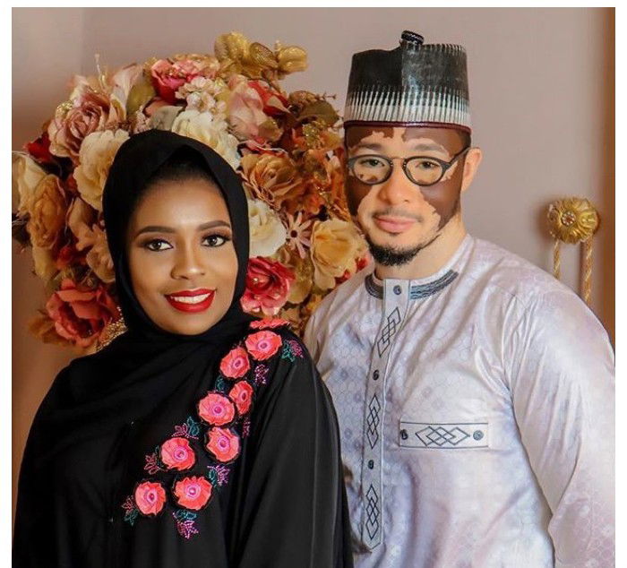 Beautiful photos from the wedding ceremony of Nigerian man who suffers from skin condition, vitiligo