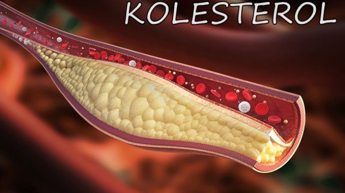 5 Makanan Ini Dapat Menurunkan Kolesterol