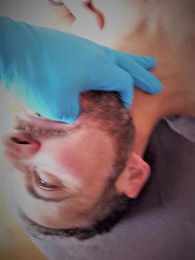 Treatment Of Temporomandibular Disorders image