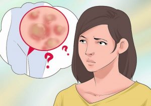 Tumbuh Daging Menggerombol Diarea Kemaluan Itu penyakit Apa