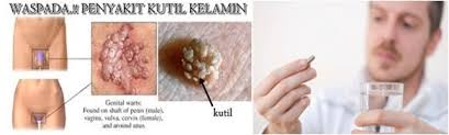 Obat Bintil Bintil Kecil Dan Kasar Diarea Kelamin