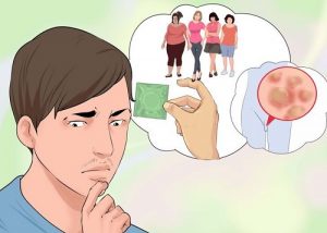 Tips Alami Mengobati Kutil di Alat Vital