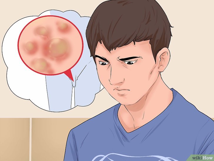 Tips Mudah Mengatasi Kutil Di Miss V