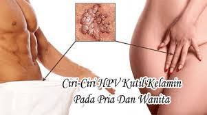 Harga Obat Daging Tumbuh Di Penis  Tanpa Oprasi