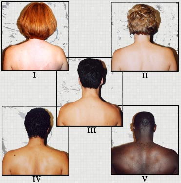 สีผิวแต่ละประเภท  ทนต่อรังสี UV ได้เท่าไหร่