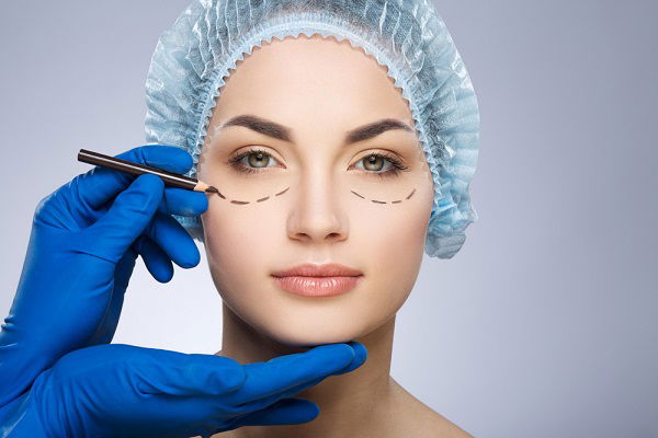 Blepharoplasty