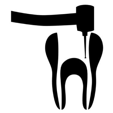 Root Canal