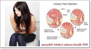 Merek Obat Yang Terbukti Ampuh untuk Penyakit Kecing Nanah